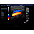 Scanner de ultra-som diagnóstico portátil novo da cor Doppler com software 3d 4d